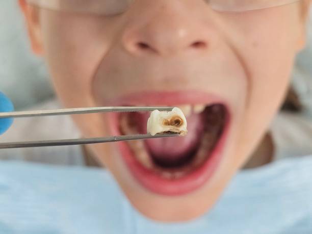 Best Emergency Cosmetic Dentistry (e.g., broken veneers) in Sheridan, AR