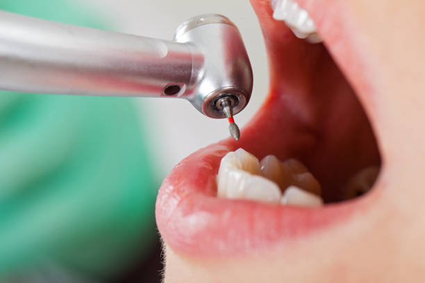 Best Emergency Cosmetic Dentistry (e.g., broken veneers) in Sheridan, AR